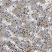 Anti-ATP8B1 antibody produced in rabbit Prestige Antibodies® Powered by Atlas Antibodies, affinity isolated antibody, buffered aqueous glycerol solution, Ab2