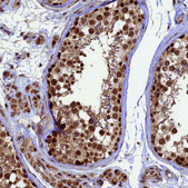 Anti-BRCA1 antibody produced in rabbit Prestige Antibodies&#174; Powered by Atlas Antibodies, affinity isolated antibody, buffered aqueous glycerol solution