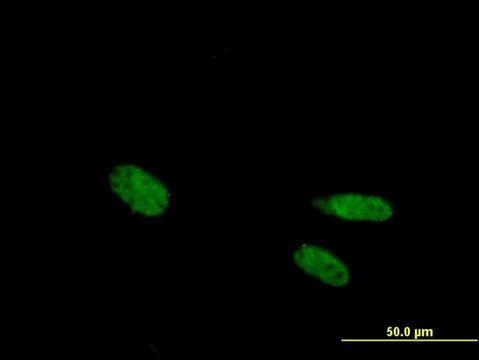 Anti-VDR antibody produced in mouse purified immunoglobulin, buffered aqueous solution