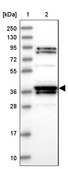 Anti-RTN4IP1 antibody produced in rabbit Prestige Antibodies® Powered by Atlas Antibodies, affinity isolated antibody, buffered aqueous glycerol solution