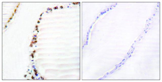 Anti-Cullin 3 antibody produced in rabbit affinity isolated antibody