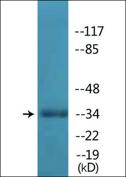 Anti-phospho-TAL-1 (pSer122) antibody produced in rabbit affinity isolated antibody