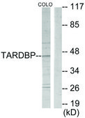 Anti-TBX1, C-Terminal antibody produced in rabbit affinity isolated antibody