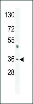 ANTI-M6PR(C-TERMINAL) antibody produced in rabbit purified immunoglobulin, buffered aqueous solution