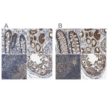 Anti-FHIT antibody produced in rabbit Prestige Antibodies&#174; Powered by Atlas Antibodies, affinity isolated antibody, buffered aqueous glycerol solution