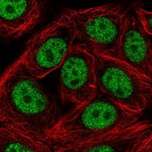 Anti-SAP30BP antibody produced in rabbit Prestige Antibodies® Powered by Atlas Antibodies, affinity isolated antibody, buffered aqueous glycerol solution