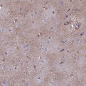 Anti-MLC1 antibody produced in rabbit Prestige Antibodies® Powered by Atlas Antibodies, affinity isolated antibody, buffered aqueous glycerol solution