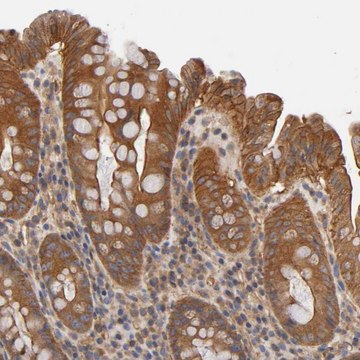 Anti-LAMTOR2 antibody produced in rabbit Prestige Antibodies&#174; Powered by Atlas Antibodies, affinity isolated antibody, buffered aqueous glycerol solution