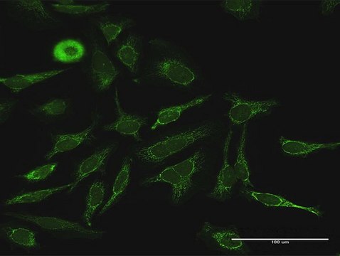 Anti-PDK4 antibody produced in rabbit purified immunoglobulin, buffered aqueous solution