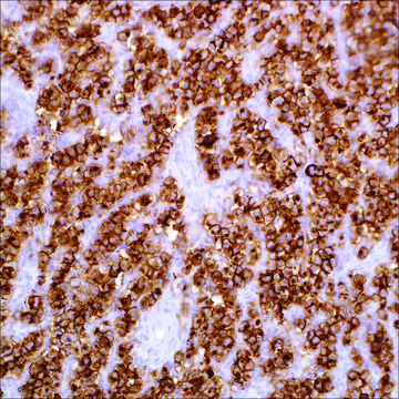 PLAP (NB10) Mouse Monoclonal Antibody