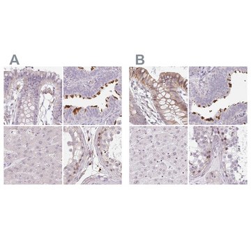 Anti-TMEM237 antibody produced in rabbit Prestige Antibodies&#174; Powered by Atlas Antibodies, affinity isolated antibody, buffered aqueous glycerol solution