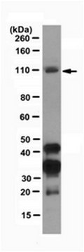 Anti-Dnmt3b Antibody, clone D3B2-2C1 clone D3B2-2C1, from rat