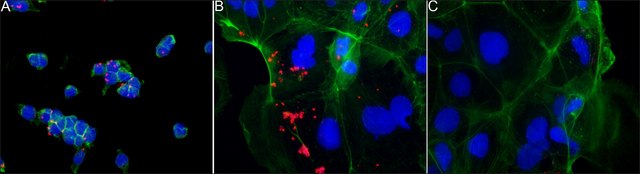 Anti- Proteus vulgaris antibody produced in rabbit IgG fraction of antiserum