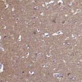 Anti-FRRS1L antibody produced in rabbit Prestige Antibodies® Powered by Atlas Antibodies, affinity isolated antibody