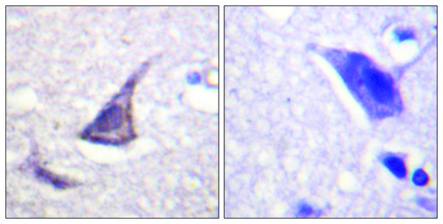 Anti-Calcium Sensing Receptor antibody produced in rabbit affinity isolated antibody