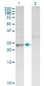 Monoclonal Anti-DTYMK antibody produced in mouse clone 2C2, ascites fluid