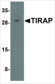 Anti-TIRAP (ab1) antibody produced in rabbit affinity isolated antibody, buffered aqueous solution