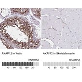Anti-AKAP12 antibody produced in rabbit Prestige Antibodies® Powered by Atlas Antibodies, affinity isolated antibody, buffered aqueous glycerol solution