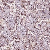 Anti-IWS1 antibody produced in rabbit Prestige Antibodies® Powered by Atlas Antibodies, affinity isolated antibody, buffered aqueous glycerol solution