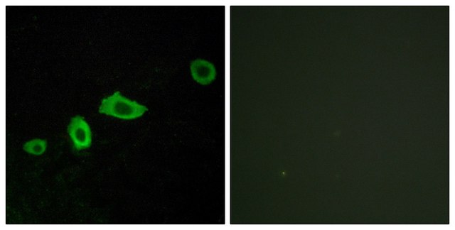 Anti-HTR5A antibody produced in rabbit affinity isolated antibody