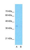 Anti-APOBEC3B antibody produced in rabbit affinity isolated antibody