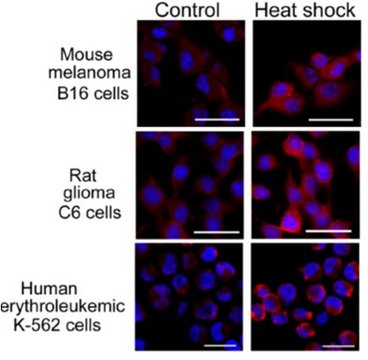 Anti-DNAJB1/Hdj1 Antibody, clone J25 clone J25, from mouse