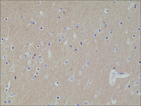 Anti-CD56 antibody, Rabbit monoclonal recombinant, expressed in HEK 293 cells, clone RM315, purified immunoglobulin