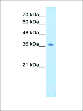 Anti-WNT16 antibody produced in rabbit IgG fraction of antiserum