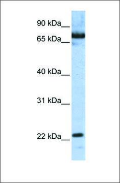 Anti-SCAND1 (ab1) antibody produced in rabbit affinity isolated antibody