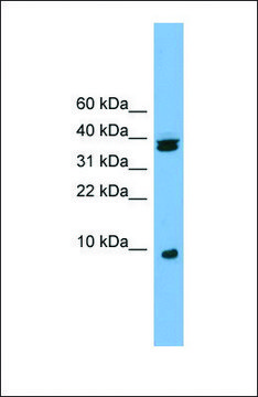 Anti-RPS21 antibody produced in rabbit affinity isolated antibody