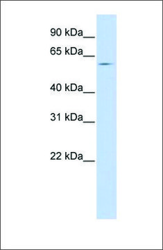 Anti-SLC15A4 antibody produced in rabbit affinity isolated antibody