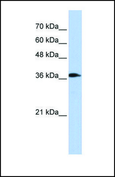 Anti-ATP6V0D2 antibody produced in rabbit affinity isolated antibody