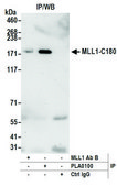 Rabbit anti-MLL1 Antibody, Affinity Purified Powered by Bethyl Laboratories, Inc.