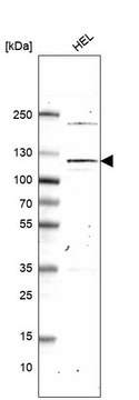 Monoclonal Anti-Pms1 Antibody Produced In Mouse Prestige Antibodies&#174; Powered by Atlas Antibodies, clone CL14436, affinity isolated antibody, buffered aqueous glycerol solution