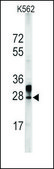 Anti-ALDH6A1 (C-term) antibody produced in rabbit affinity isolated antibody, buffered aqueous solution