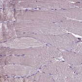 Anti-CPM antibody produced in rabbit affinity isolated antibody, buffered aqueous glycerol solution