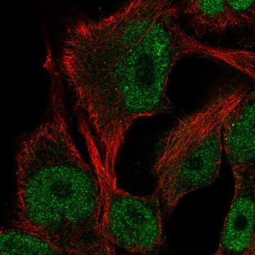 Anti-ITPKB antibody produced in rabbit Prestige Antibodies&#174; Powered by Atlas Antibodies, affinity isolated antibody