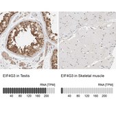 Anti-EIF4G3 antibody produced in rabbit Prestige Antibodies® Powered by Atlas Antibodies, affinity isolated antibody, buffered aqueous glycerol solution, Ab1