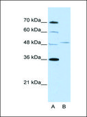 Anti-FOXQ1 (AB2) antibody produced in rabbit IgG fraction of antiserum