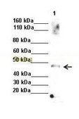 Anti-TXNIP antibody produced in rabbit affinity isolated antibody