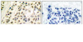 Anti-DP-1, C-Terminal antibody produced in rabbit affinity isolated antibody